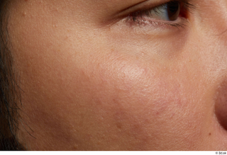 HD Face Skin Allvince Epps cheek eye face skin pores…